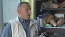 Me sytë nga donatorët, personat me gjymtyrë të amputuara kanë nevojë për prot...