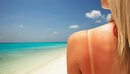 Kujdesi dermatologjik në verë: Si të mbrojmë lëkurën nga dëmtimet e diellit, ...