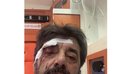 Dhunohet analisti Ilir Demalia në Tiranë, shpallet në kërkim autori 