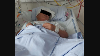 Apel për ndihmë: 59-vjeçarja shqiptare pëson hemorragji cerebrale dhe mbetet në Danimarkë, familja kërkon mbështetje për ta shpëtuar