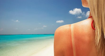 Kujdesi dermatologjik në verë: Si të mbrojmë lëkurën nga dëmtimet e diellit, ja mitet