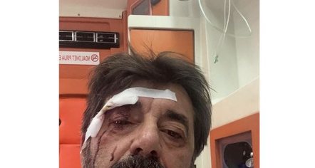 Dhunohet analisti Ilir Demalia në Tiranë, shpallet në kërkim autori 