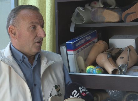 Me sytë nga donatorët, personat me gjymtyrë të amputuara kanë nevojë për proteza