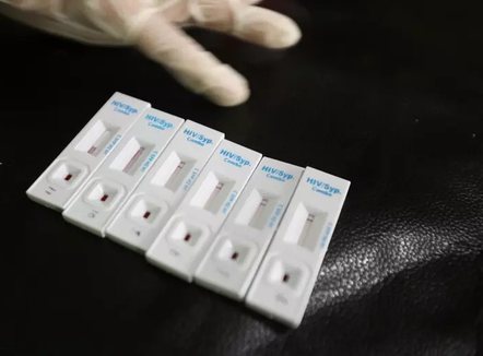 OBSH jep alarmin: Gjysma e diagnozave të HIV në Europë zbulohen shumë vonë