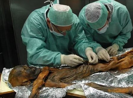 Zbulohet se mumia Ötzi ishte e infektuar me papilloma virus