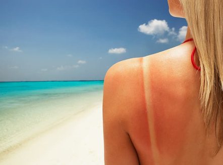 Kujdesi dermatologjik në verë: Si të mbrojmë lëkurën nga dëmtimet e diellit, ja mitet