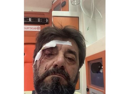 Dhunohet analisti Ilir Demalia në Tiranë, shpallet në kërkim autori 