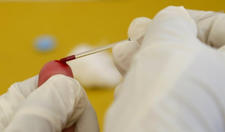 HIV virus on the rise in Kosovo, 10 new cases in five months