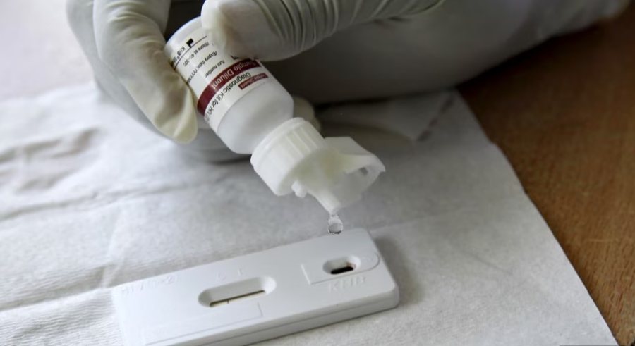 Një person i vdekur, 19 raste të reja me HIV gjatë këtij