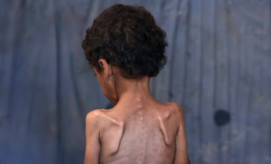 Save the Children: Fëmijët e uritur në Gaza nuk kanë