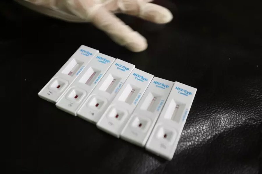 OBSH jep alarmin: Gjysma e diagnozave të HIV në Europë zbulohen