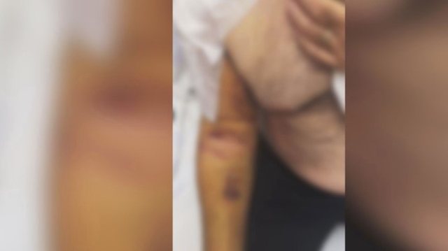 Skandali në Dibër/ Qytetarit i thyen krahun brenda Kadastrës,