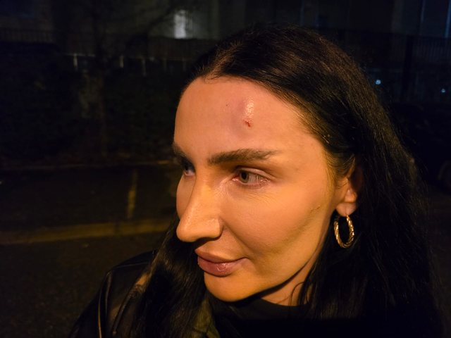 Tensions at the protest/ Police shoot former candidate for deputy with rubber