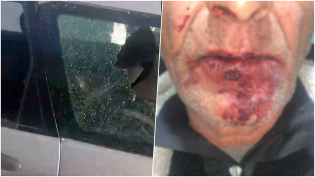 FOTO/ &Ccedil;ifti u dhunua brenda makin&euml;s nga disa persona n&euml;