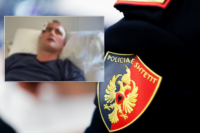 E rëndë në Fier/ Babë e bir dhunohen brutalisht në