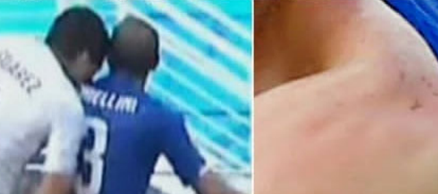 Histori nga Botërori/ “Vampiri” Suarez kafshoi sërish,