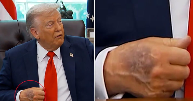 Fotot e dorës së nxirë të Donald Trump, Shtëpia e
