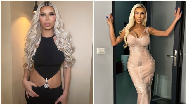 Edona James hap faqe në “OnlyFans”, tarifa që vendosi