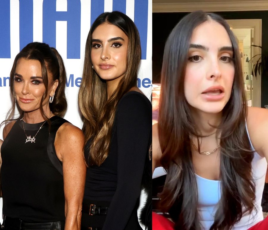 "Tullace brenda një jave": Sophia Umansky tregon efektet e