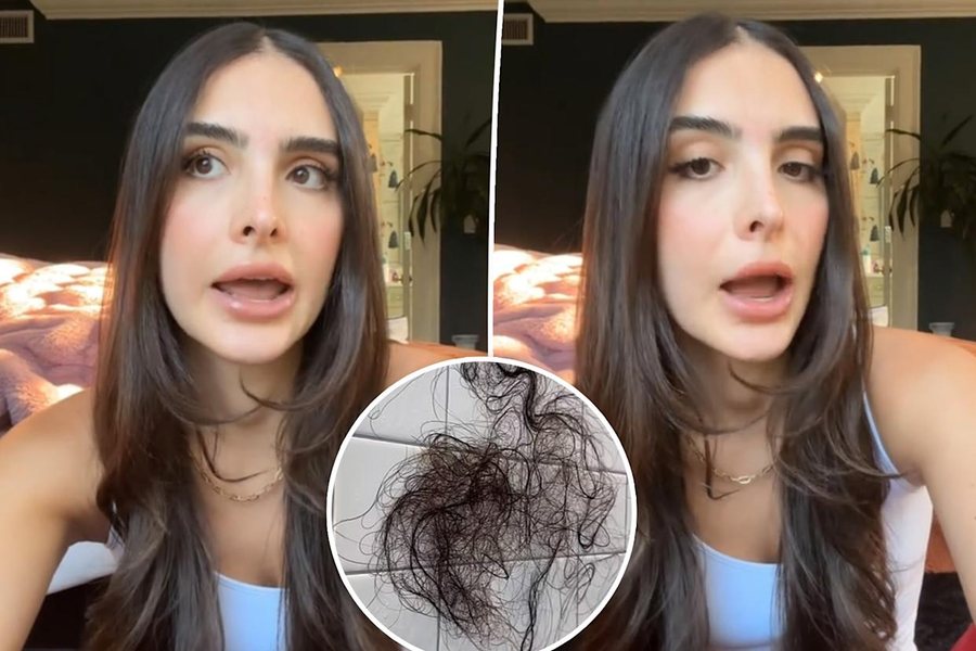 "Tullace brenda një jave": Sophia Umansky tregon efektet e