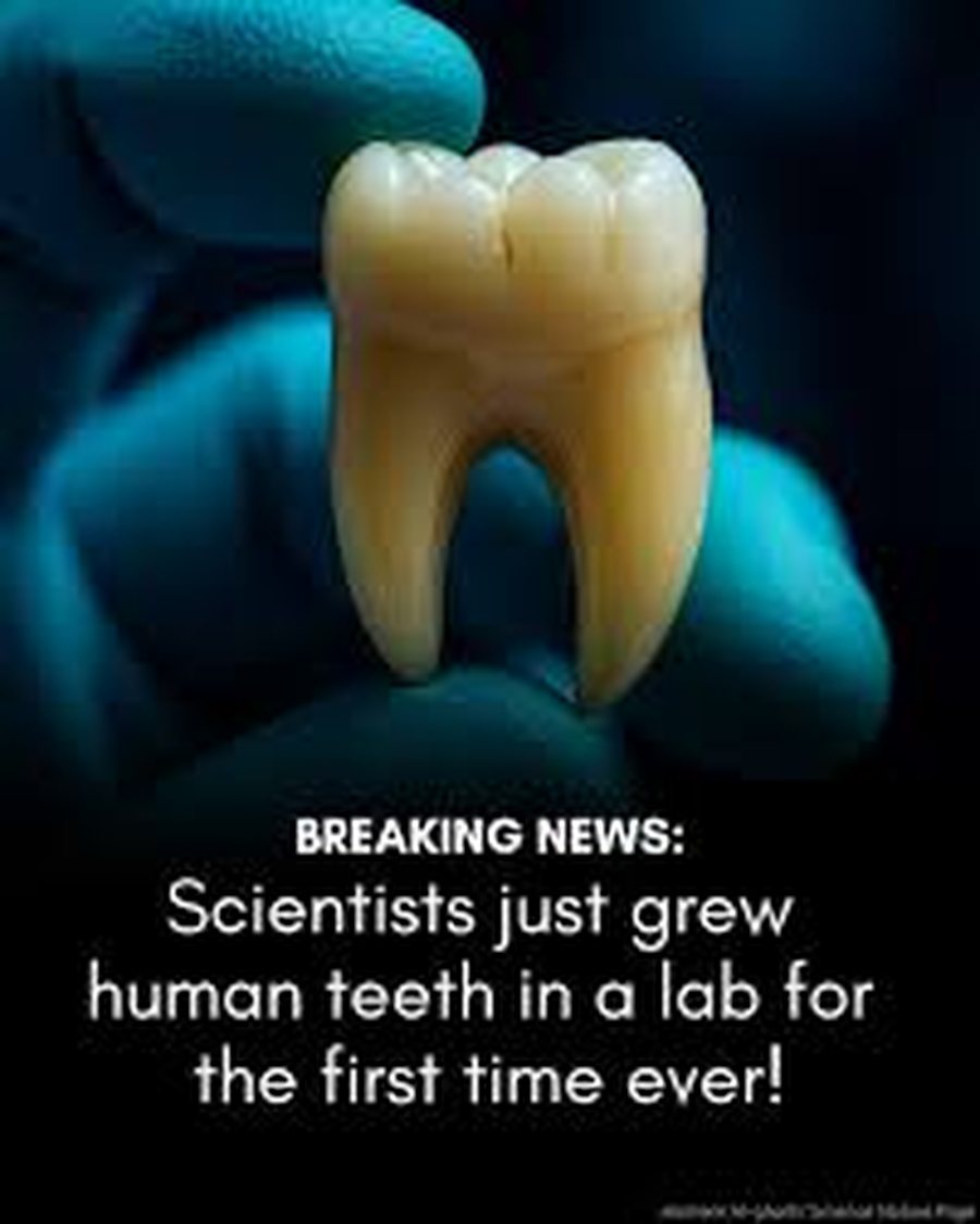 “Jo më ura dentare”, në të ardhmen dhëmbë