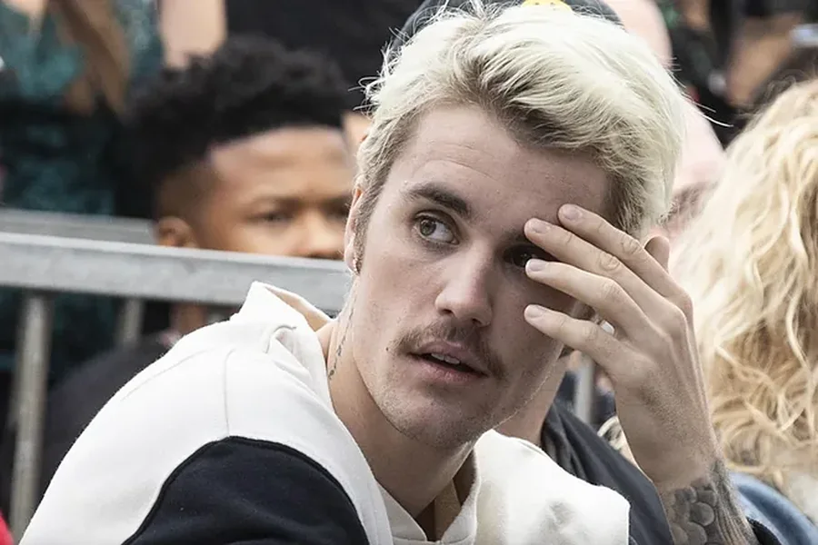 Justin Bieber vijon të shqetësojë fansat me gjendjen e tij: