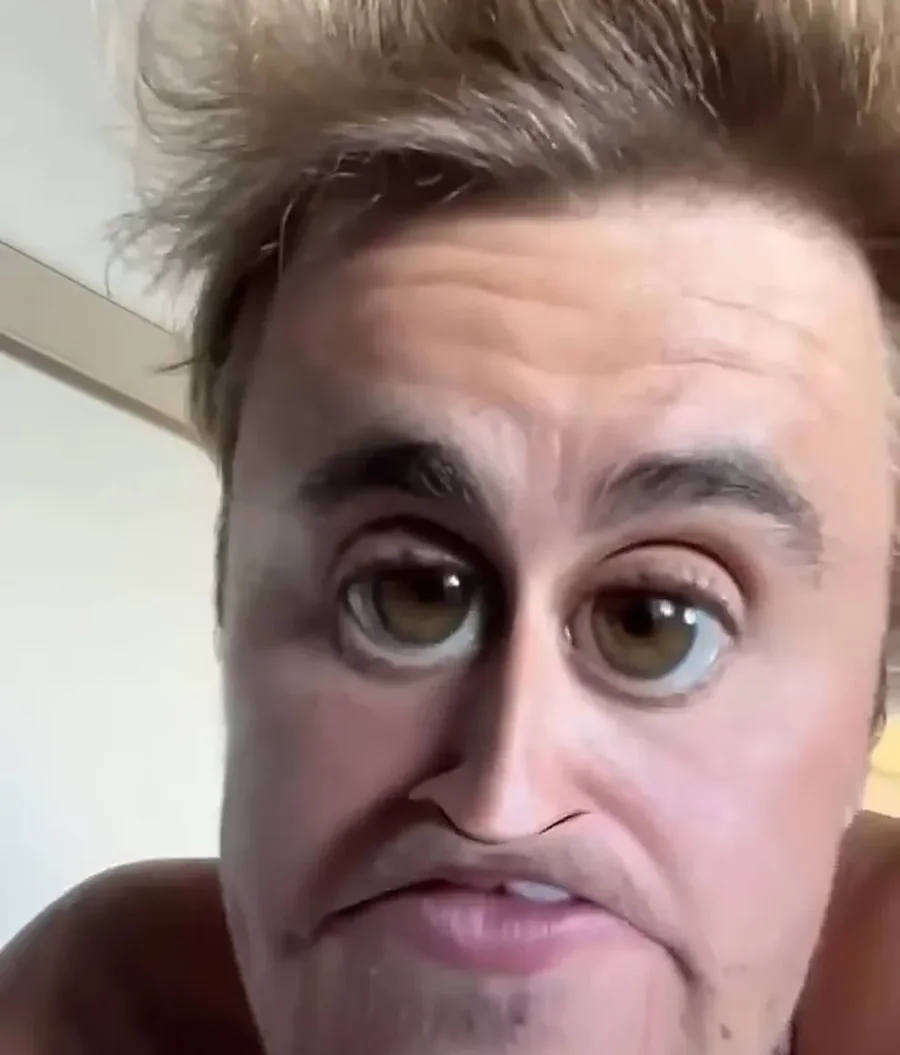 Justin Bieber vijon të shqetësojë fansat me gjendjen e tij: