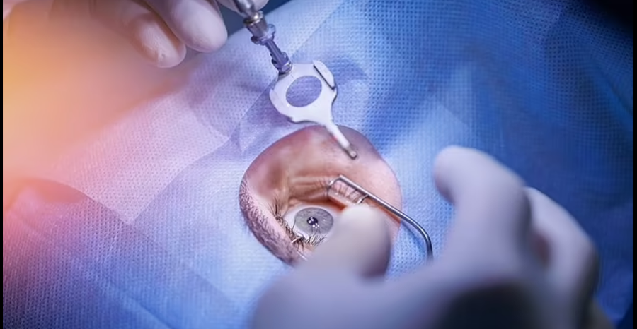 Operacioni Lasik, dhimbje të tmerrshme-Vetëvritet efekti i