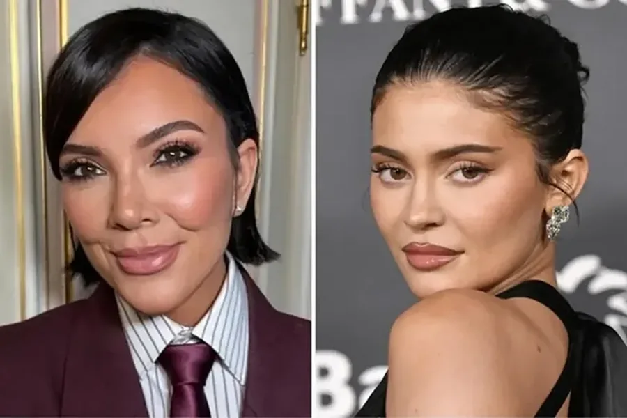 Me ndërhyrjet estetike, Kris Jenner 69 vjeçe duket më e re se