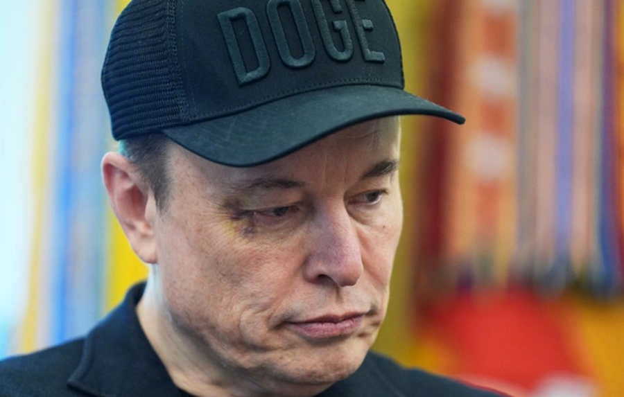U shfaq me sy të nxirë në krah të Trump, Musk zbulon se kush