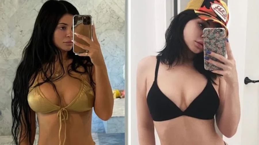 “445 cc, gjysma nën muskul dhe..” Kylie Jenner ndihmon fansen,