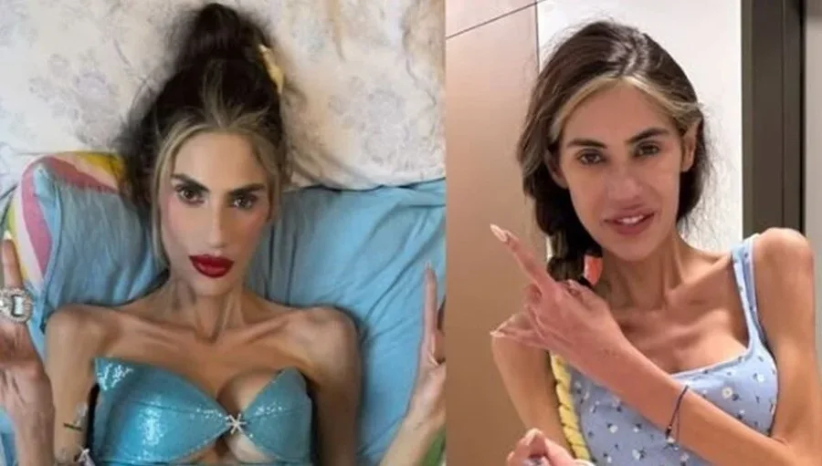 U dobësua shumë, vdes influencuesja e famshme turke!