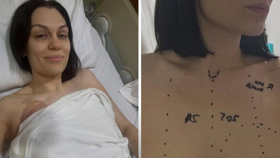 Habit Jessie J pas operacionit: Kanceri është zhdukur!