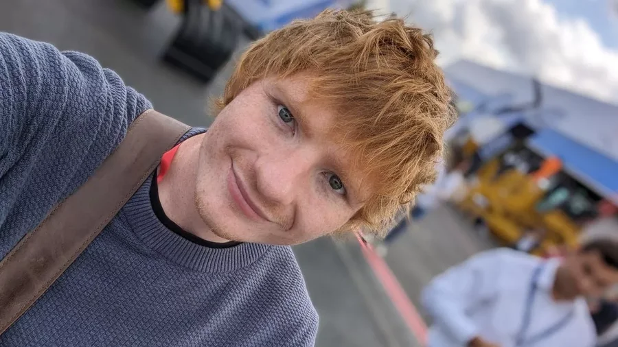 Sulmohet brutalisht sozia i Ed Sheeran: "Mendova se po vdisja"!
