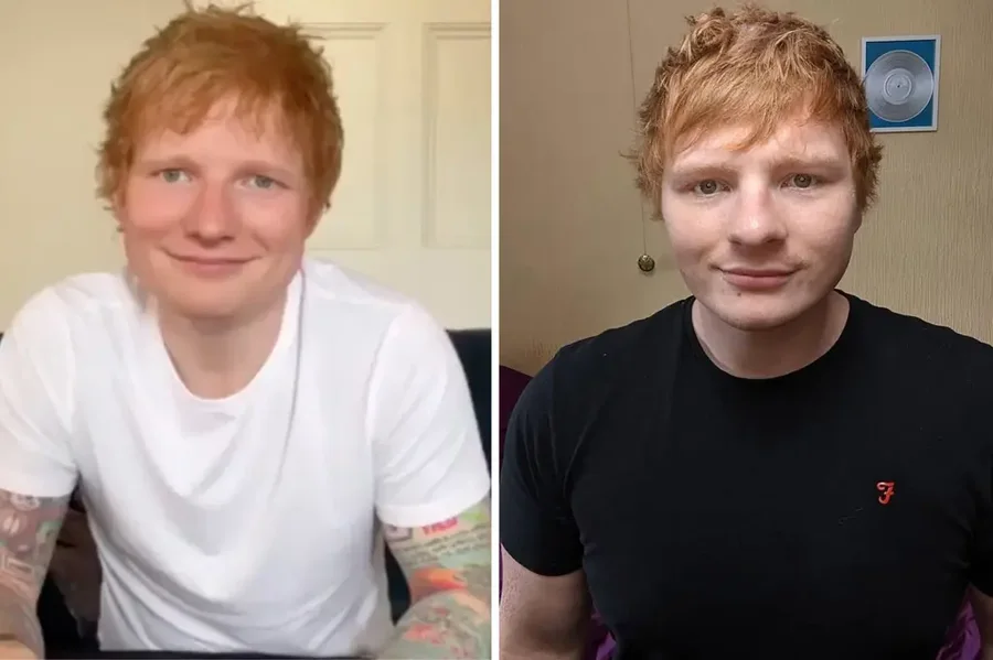 Sulmohet brutalisht sozia i Ed Sheeran: "Mendova se po vdisja"!