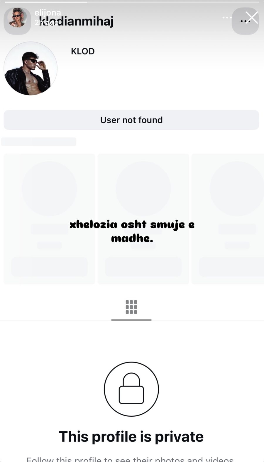 Klodi humb aksesin në Instagram, Elijona shpërthen me reagimin e saj
