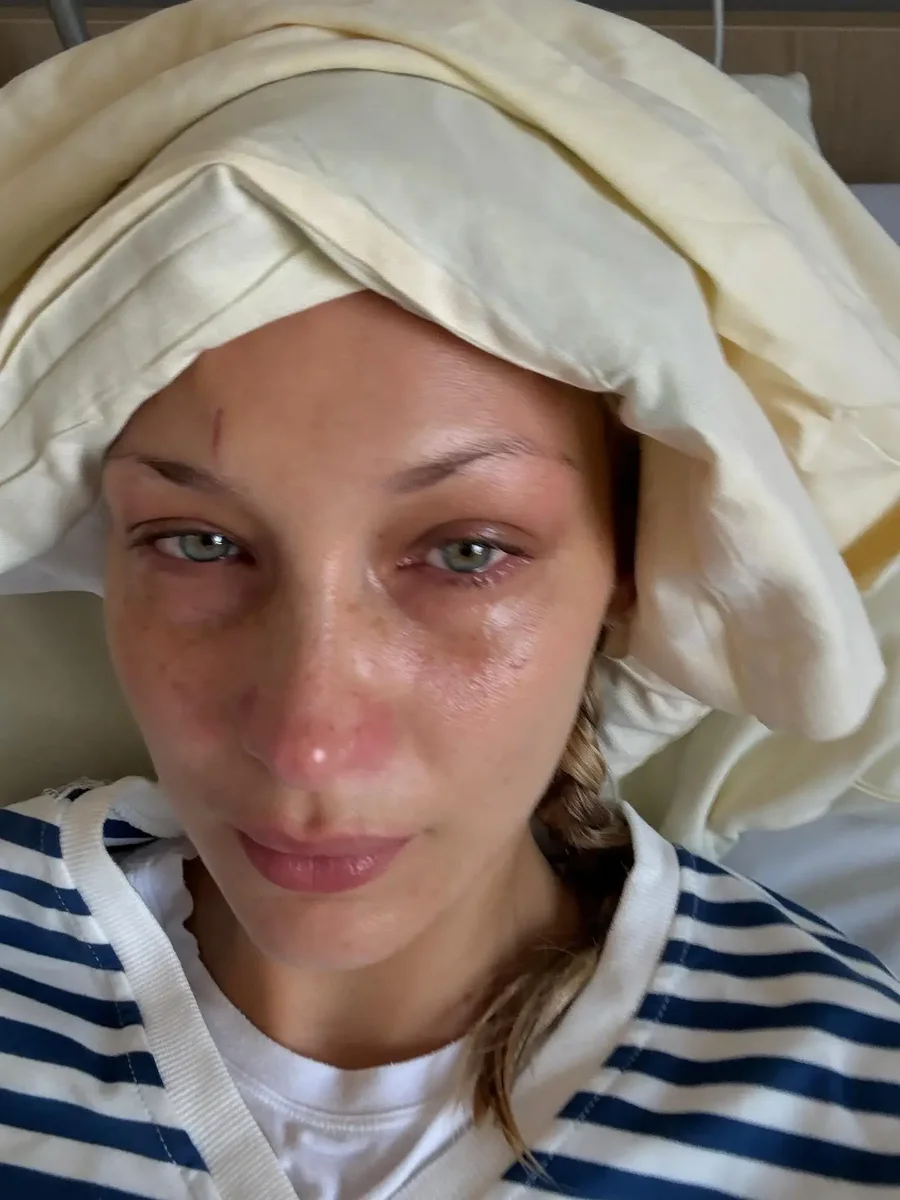 &ldquo;Asgj&euml; nuk po m&euml; ndihmon&rdquo;, Bella Hadid rr&euml;fen n&euml;