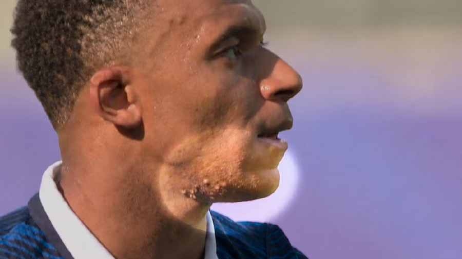 Nga teorit&euml; p&euml;r doping te shpjegimi mjek&euml;sor: