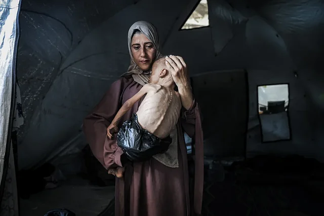 Nga fëmijët e uritur në Gaza tek shqiptari që shpëtoi
