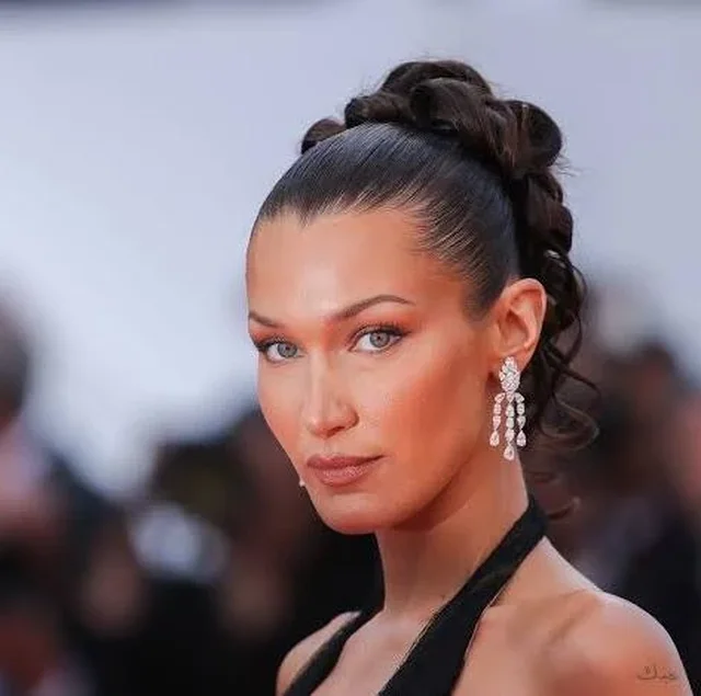 Modelja Bella Hadid n&euml; gjendje t&euml; keqe sh&euml;ndet&euml;sore me