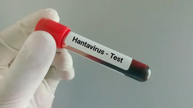 &nbsp;Hantavirusi prek Venezuel&euml;n, humbin jet&euml;n tre persona