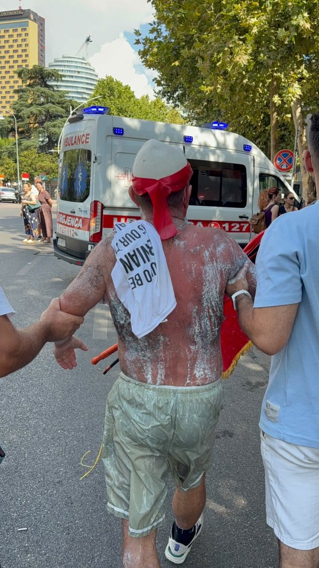 VIDEO/ Lëkurë e skuqur dhe vështirësi në