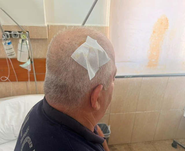 P&euml;rplasjet para Kuvendit, 5 efektiv&euml; policie t&euml; plagosur, tre