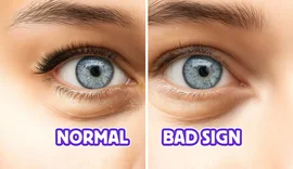 5 shenja paralajmëruese që mund të keni intolerancë ndaj