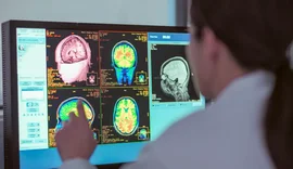 Nga adoleshenca tek demenca: Pesë fazat që formojnë trurin