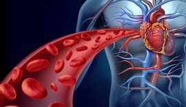 Ateroskleroza, armiku i padukshëm! Flet kardiologu