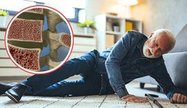 Sëmundjet e kockave! Si t’i dalloni dhe si t’i parandaloni