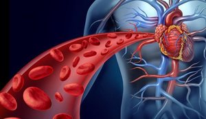 Ateroskleroza, armiku i padukshëm! Flet kardiologu