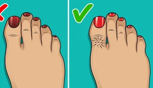 Çfarë ju tregojnë këmbët për shëndetin? 9