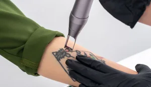 Zbulohet lidhja mes tatuazheve dhe kancerit!